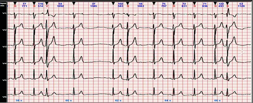 Electrocardiograph Certification Testing Laboratory(图1)